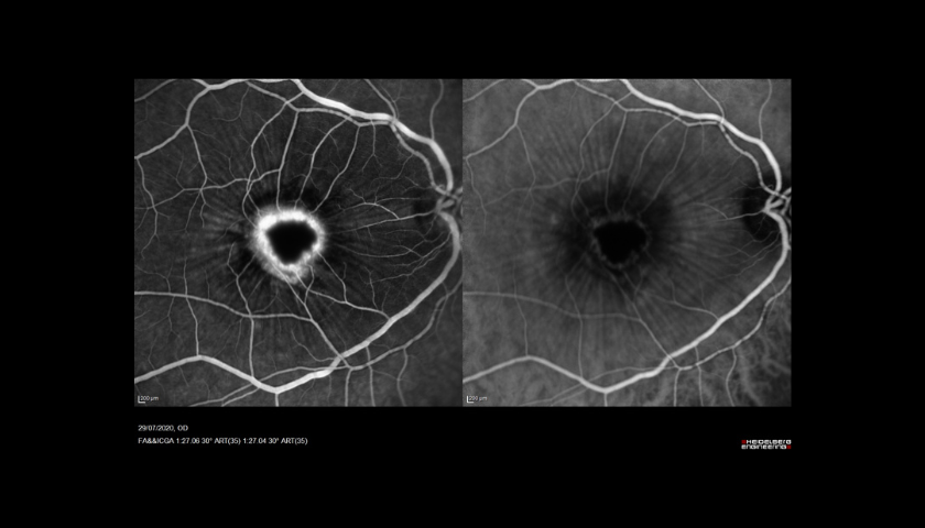 Angiografia