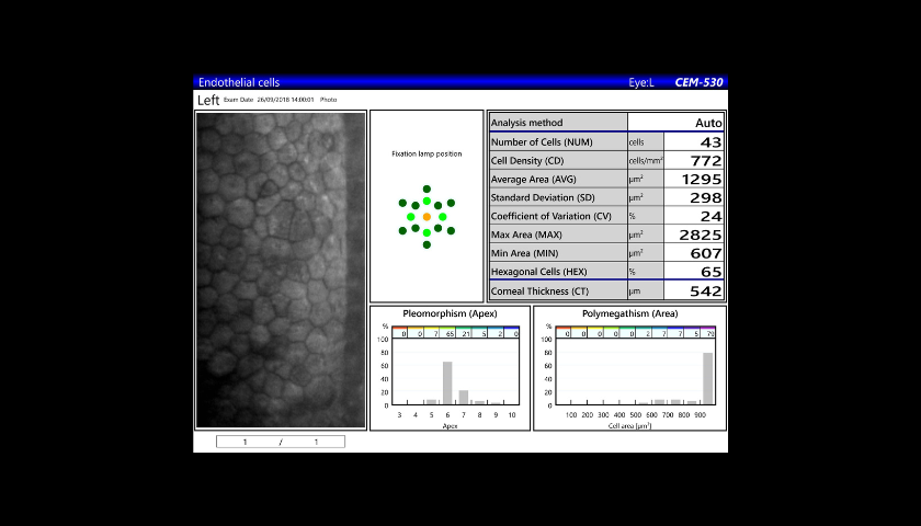 biomicroscopia-especular-2
