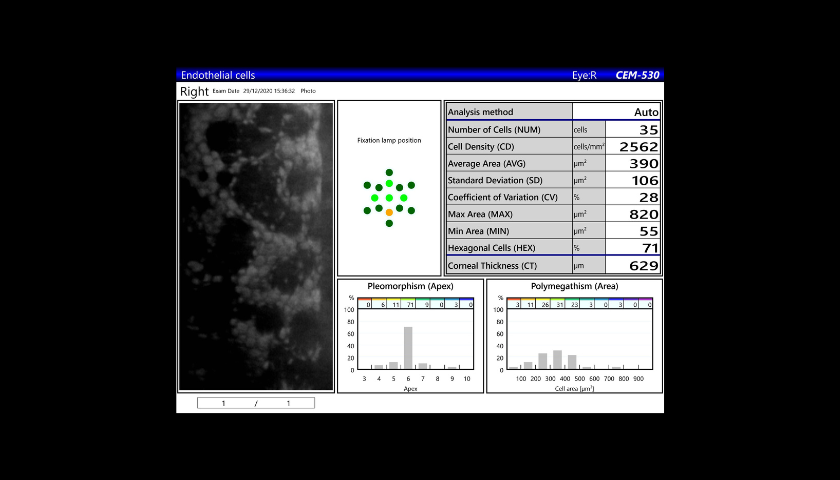 biomicroscopia-especular